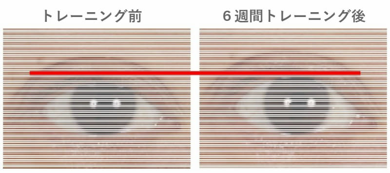 上眼瞼挙筋 トレーニング効果