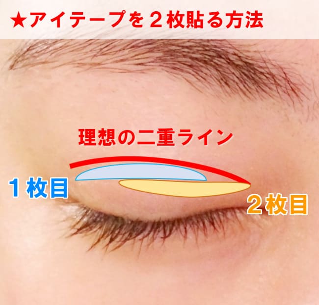 アイテープ 貼り方