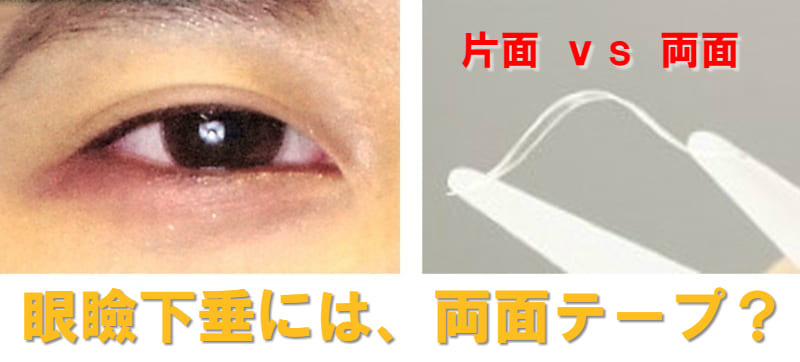 眼瞼下垂 アイテープ 両面