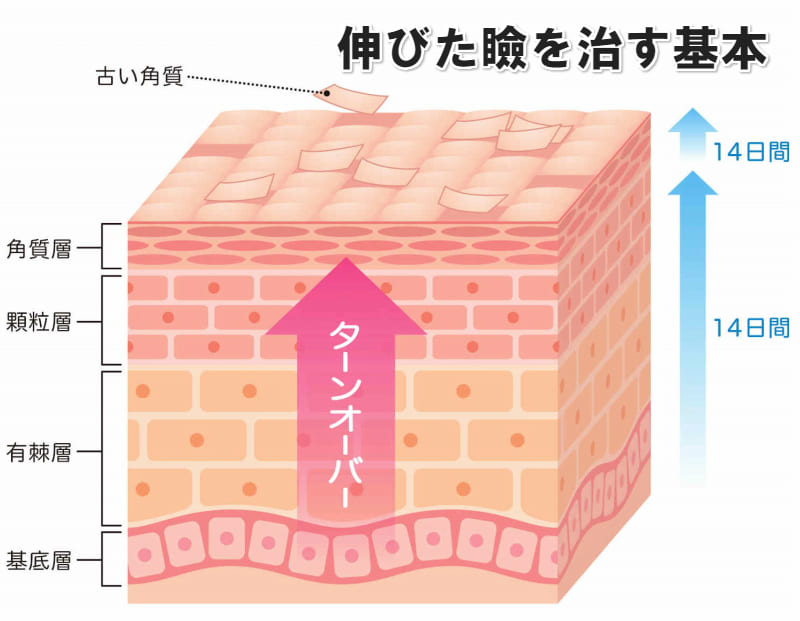 伸びた皮膚 ターンオーバー