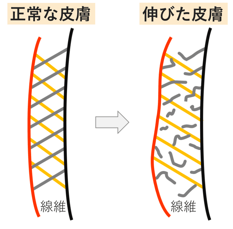 伸びた皮膚