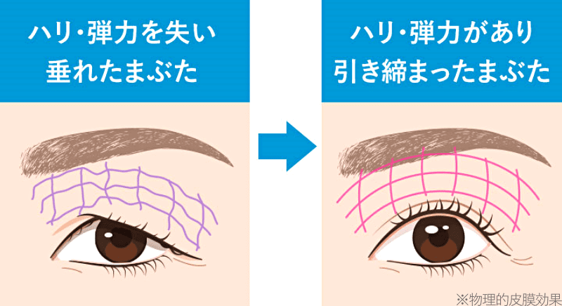 リッドキララ ハリ 効果